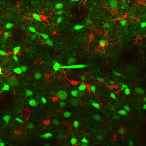 Los-astrocitos-ayudan-a-coordinar-la-actividad-neuronal_image800_