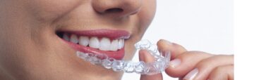 1477289859_ortodoncia_invisalign_alineadores