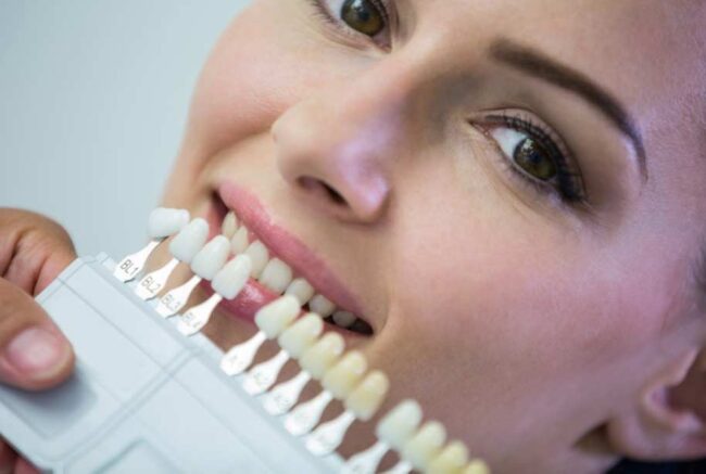 implantes dentales