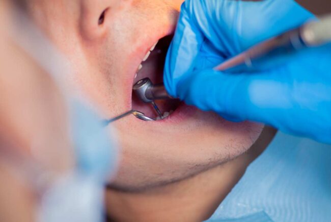 Tratamientos dentales en Las Palmas: salud bucodental