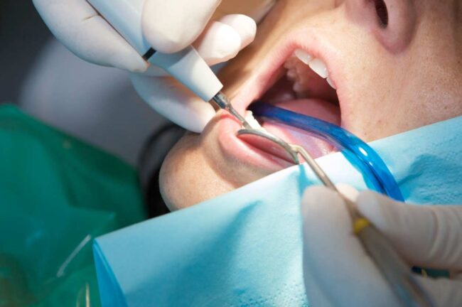 Tratamientos dentales para una boca sana en Tegueste Candás 365 Tratamientos dentales para una boca sana en Tegueste