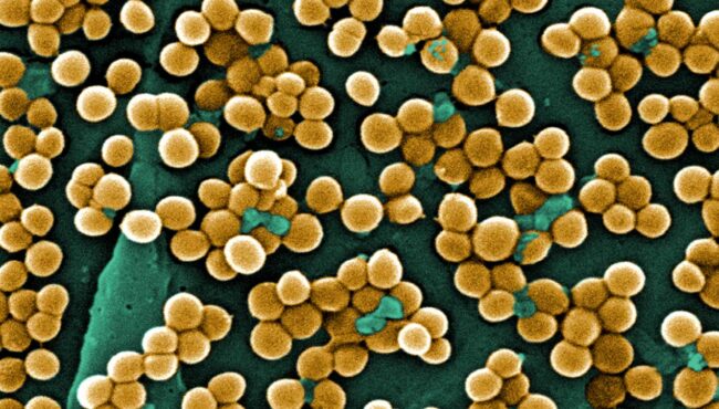 El CSIC investiga nuevos materiales antimicrobianos